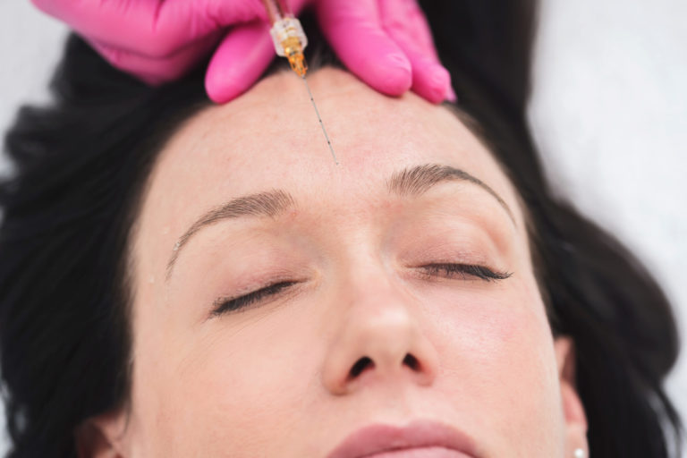 Radiesse: The Dermal Filler for Your Smooth Skin and Wrinkles