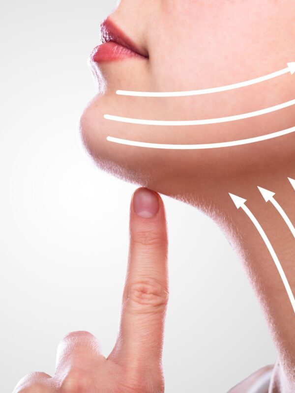 Liquid Facelift with PRF (platelet-rich fibrin)