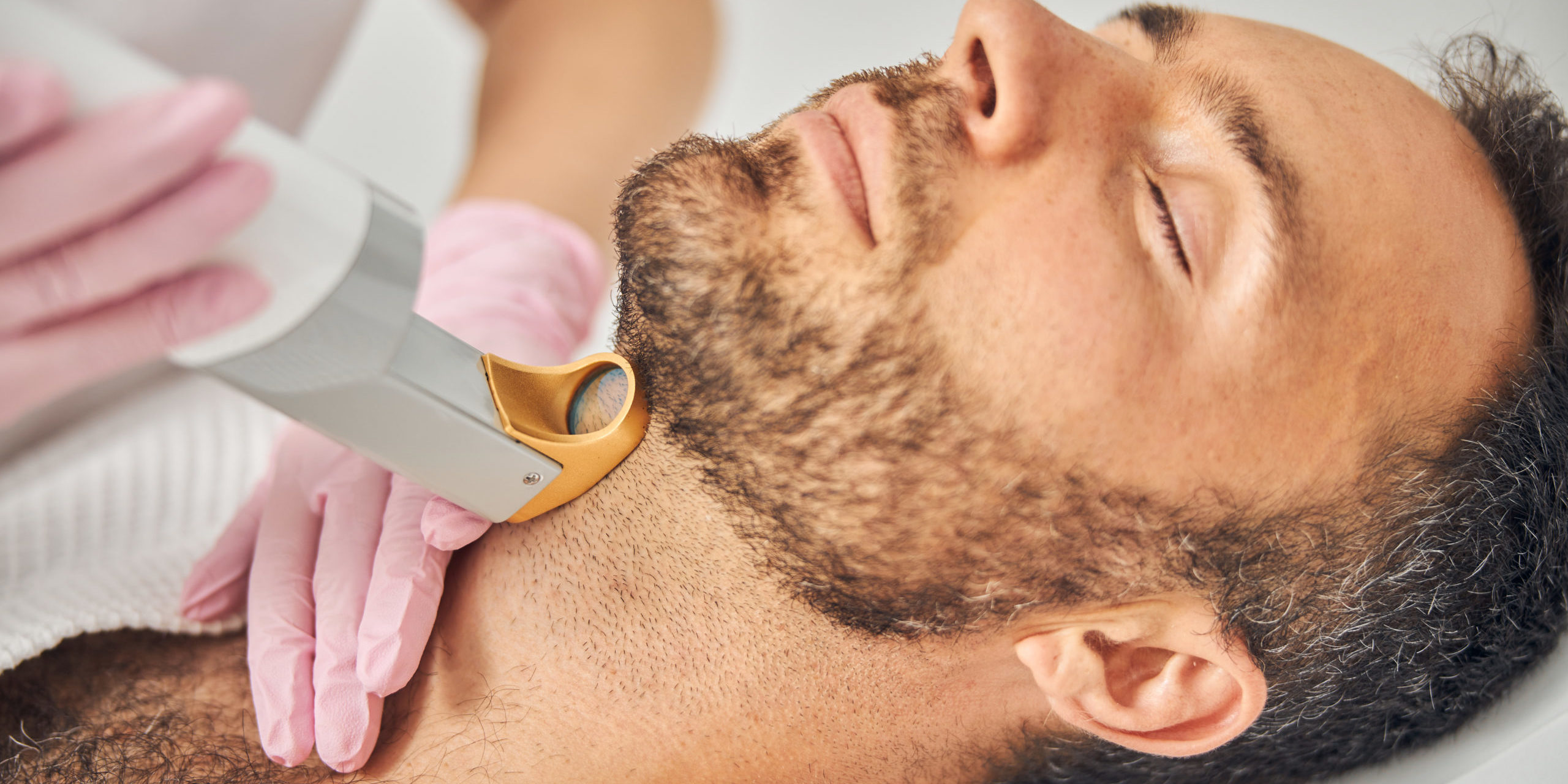 Unleash the Power of Laser Hair Remover